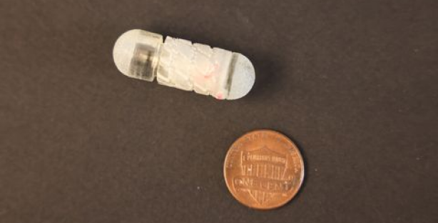 Инсулинни организмга “укол”сиз етказиб берувчи робот-капсула яратилди