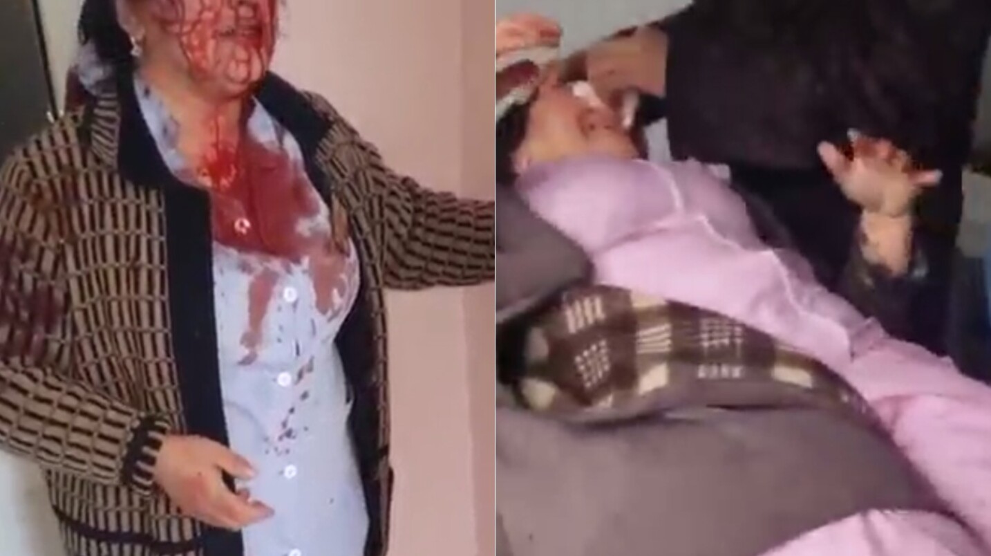 «Ударила чайником по лицу»: в Самарканде из-за разногласий подрались медики — видео