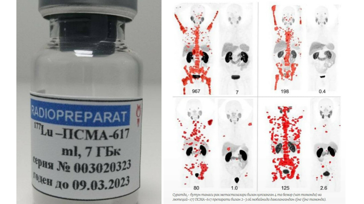 UzNews - В Академии наук предоставили дополнительную информацию о препарате  от рака