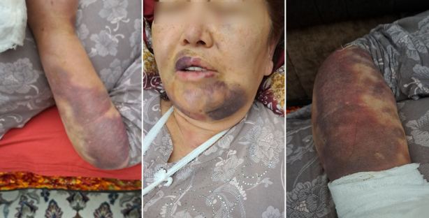 В Ташкенте жестоко избита мать помощника хокима Мирзо-Улугбекского района