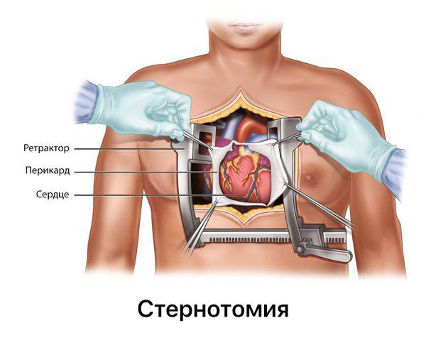 Строгий запрет: 8 случаев, когда нельзя заниматься сексом